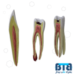 دندان سری 3 عددی