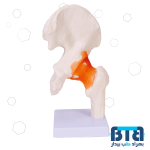 مولاژ مفصل ران با نمایش رباط اندازه طبیعی